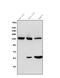 Ceruloplasmin antibody, PB9853, Boster Biological Technology, Western Blot image 