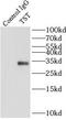 Thiosulfate Sulfurtransferase antibody, FNab09073, FineTest, Immunoprecipitation image 