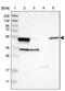 Aldehyde Dehydrogenase 3 Family Member A2 antibody, PA5-53232, Invitrogen Antibodies, Western Blot image 