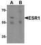 Estrogen Receptor 1 antibody, TA319645, Origene, Western Blot image 