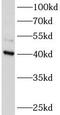 Ataxin 3 Like antibody, FNab00743, FineTest, Western Blot image 