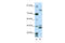Zinc Finger Protein 607 antibody, 28-424, ProSci, Western Blot image 