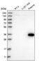 Zinc Finger Protein 101 antibody, PA5-54804, Invitrogen Antibodies, Western Blot image 