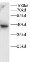 MOK Protein Kinase antibody, FNab10103, FineTest, Western Blot image 