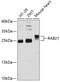 Ras-related protein Rab-21 antibody, GTX64938, GeneTex, Western Blot image 