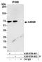 Caspase Recruitment Domain Family Member 9 antibody, A305-878A-M, Bethyl Labs, Immunoprecipitation image 