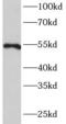 Matrix Metallopeptidase 20 antibody, FNab05239, FineTest, Western Blot image 