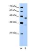 G Protein-Coupled Receptor 161 antibody, NBP1-60114, Novus Biologicals, Western Blot image 