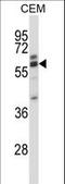 Coronin 2A antibody, LS-C166955, Lifespan Biosciences, Western Blot image 