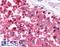 Cell Division Cycle 25A antibody, LS-B1463, Lifespan Biosciences, Immunohistochemistry paraffin image 