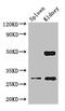 Dimethylarginine Dimethylaminohydrolase 2 antibody, CSB-PA006580LA01HU, Cusabio, Western Blot image 