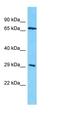 Kelch Repeat And BTB Domain Containing 12 antibody, orb327009, Biorbyt, Western Blot image 