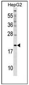 HGb antibody, AP51162PU-N, Origene, Western Blot image 