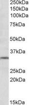 Metabotropic glutamate receptor 2 antibody, TA311144, Origene, Western Blot image 