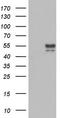CD5 Molecule antibody, LS-C797967, Lifespan Biosciences, Western Blot image 