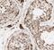 Exoribonuclease 1 antibody, FNab02843, FineTest, Immunohistochemistry paraffin image 