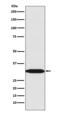 Rea antibody, M03315-1, Boster Biological Technology, Western Blot image 