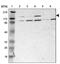 Phosphorylase Kinase Regulatory Subunit Alpha 1 antibody, PA5-51508, Invitrogen Antibodies, Western Blot image 