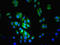 Lysosomal acid lipase/cholesteryl ester hydrolase antibody, LS-C317785, Lifespan Biosciences, Immunofluorescence image 