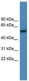 Adrenoceptor Alpha 1D antibody, TA342794, Origene, Western Blot image 