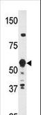 Zinc finger protein 395 antibody, LS-B10560, Lifespan Biosciences, Western Blot image 
