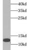Trefoil Factor 1 antibody, FNab08958, FineTest, Western Blot image 
