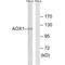 AOX1 antibody, A02144, Boster Biological Technology, Western Blot image 