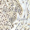 Replication factor C subunit 5 antibody, A8056, ABclonal Technology, Immunohistochemistry paraffin image 