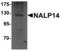 NLR Family Pyrin Domain Containing 14 antibody, LS-B5338, Lifespan Biosciences, Western Blot image 