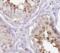 Palmitoyltransferase ZDHHC17 antibody, FNab03868, FineTest, Immunohistochemistry frozen image 