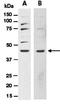 Sonic Hedgehog Signaling Molecule antibody, orb66796, Biorbyt, Western Blot image 
