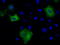 Bruton Tyrosine Kinase antibody, TA501101, Origene, Immunofluorescence image 