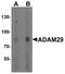 ADAM Metallopeptidase Domain 29 antibody, A07531, Boster Biological Technology, Western Blot image 
