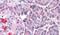 Leucine Rich Repeat Neuronal 4 antibody, PA5-33910, Invitrogen Antibodies, Immunohistochemistry frozen image 