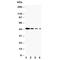 Delta Like Canonical Notch Ligand 1 antibody, R31011, NSJ Bioreagents, Western Blot image 