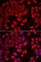 Chaperonin Containing TCP1 Subunit 2 antibody, LS-C335687, Lifespan Biosciences, Immunofluorescence image 
