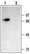 BNC1 antibody, TA329036, Origene, Western Blot image 