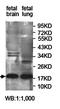 Jumping Translocation Breakpoint antibody, orb78108, Biorbyt, Western Blot image 