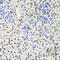Elongation Factor Tu GTP Binding Domain Containing 2 antibody, 22-651, ProSci, Immunohistochemistry paraffin image 