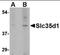 UDP-glucuronic acid/UDP-N-acetylgalactosamine transporter antibody, orb94257, Biorbyt, Western Blot image 