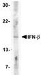 Mitogen-Activated Protein Kinase Kinase 1 antibody, orb14908, Biorbyt, Western Blot image 