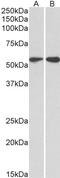 Vimentin antibody, STJ73113, St John