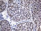 Zinc Finger Protein 2 antibody, LS-C795727, Lifespan Biosciences, Immunohistochemistry paraffin image 
