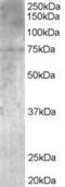 MAGUK p55 subfamily member 5 antibody, 45-898, ProSci, Western Blot image 