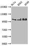XPA Binding Protein 2 antibody, CSB-PA862073LA01HU, Cusabio, Western Blot image 