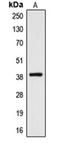 Cysteinyl Leukotriene Receptor 2 antibody, orb215239, Biorbyt, Western Blot image 