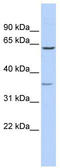 Nipsnap Homolog 2 antibody, TA346549, Origene, Western Blot image 