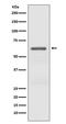 Protein Kinase AMP-Activated Catalytic Subunit Alpha 2 antibody, P01420-2, Boster Biological Technology, Western Blot image 