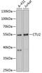 Cytoplasmic tRNA 2-thiolation protein 2 antibody, 14-740, ProSci, Western Blot image 