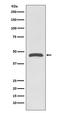 Tumor Susceptibility 101 antibody, M01233, Boster Biological Technology, Western Blot image 